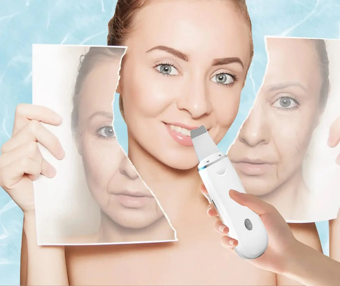 Aparat de curatare faciala cu microvibratii, lifting ten, skin scrubber, indepartare puncte negre