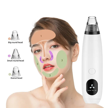 Aparat pentru scos puncte negre, lifting, baterii sau acumulatori, 3 nivele de absorbtie, dispay, alb
