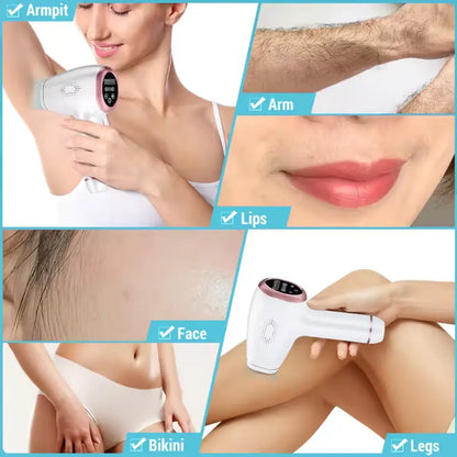 Epilator IPL W1091 pentru epilare definitivă, BESEDER, 5 trepte de intensitate, display LCD